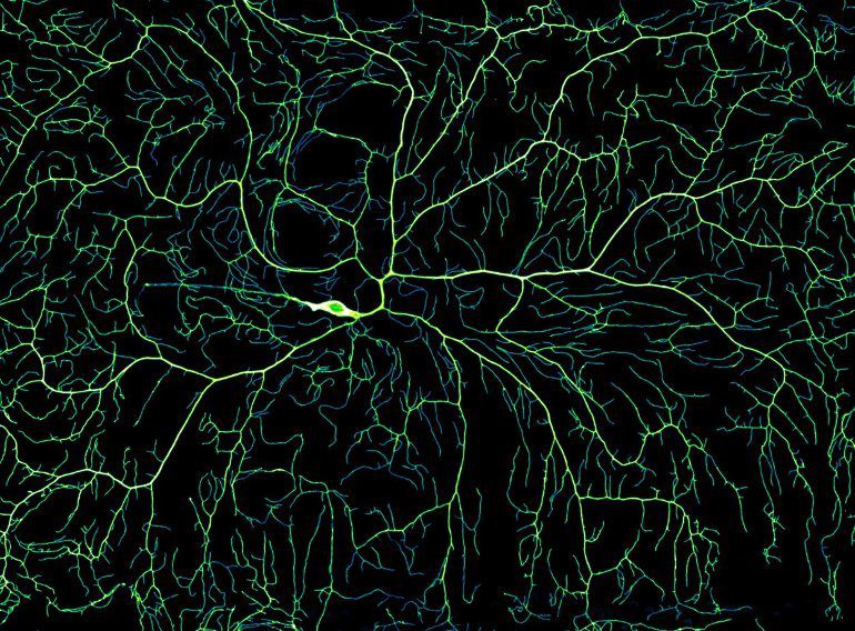 Researchers visualize the complex ramifications of the nervous system